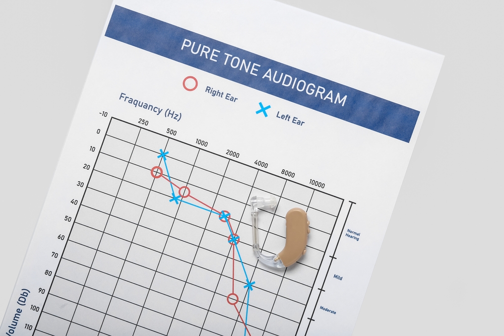 Understanding Your Audiogram A Simple Explanation